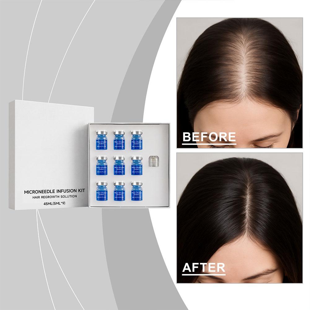 Hair Care Routine - Set Rol Jarum Mikro Serum Esensial