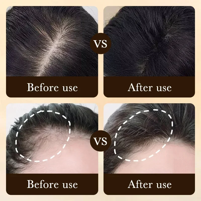Produk Minyak Penumbuh Rambut  - Hair Care Essence Oil ulasan dan harga