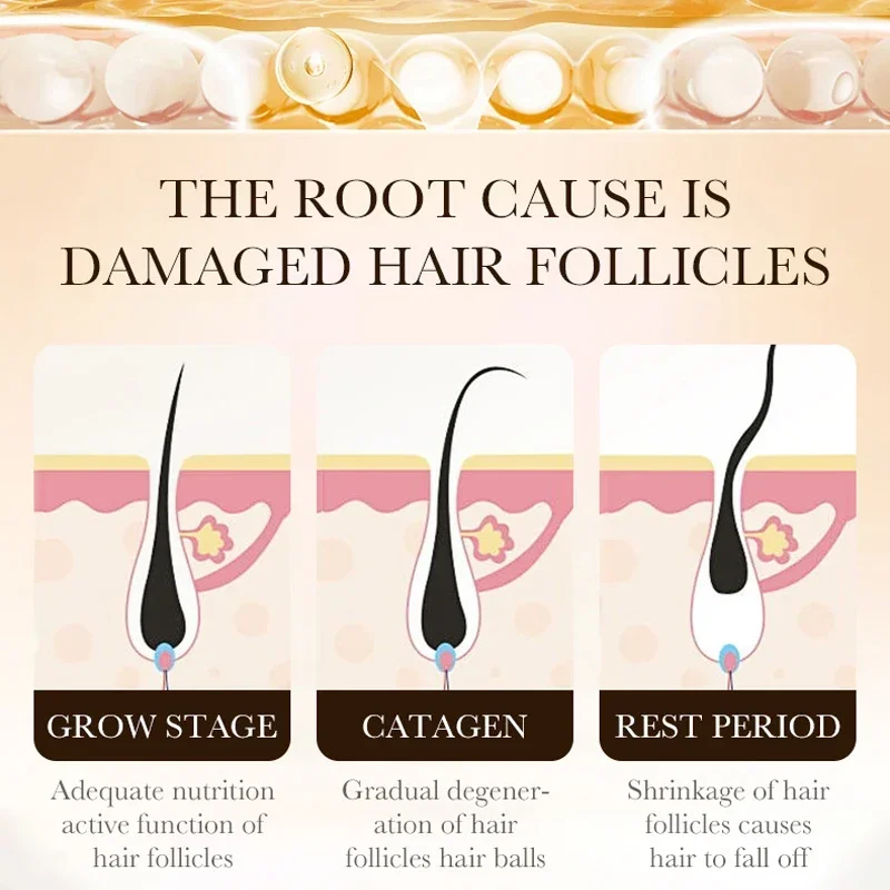 Produk Minyak Penumbuh Rambut  - Hair Care Essence Oil ulasan dan harga